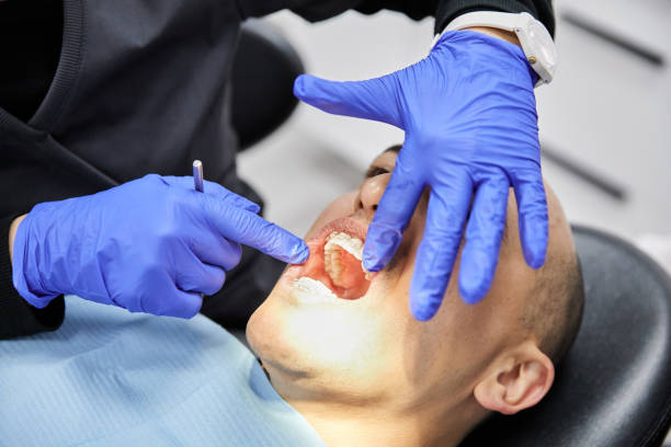 Best Knocked-Out Tooth Emergency  in Mvern, AL